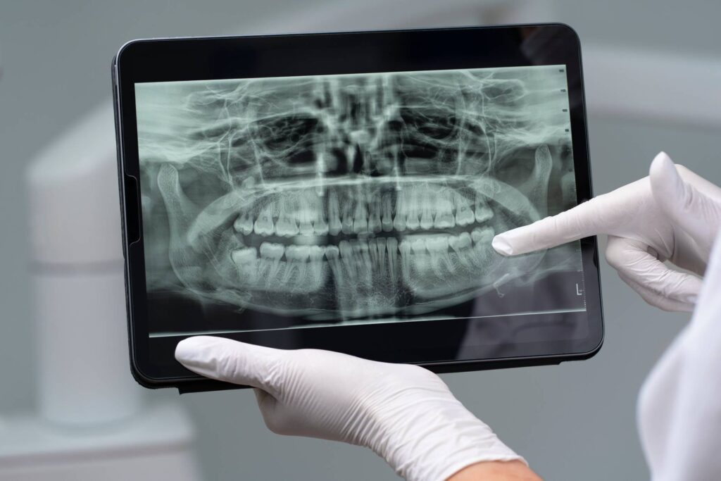 Trexler Family Dental Group Technology Digital X-ray Image